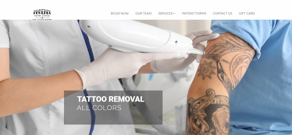 Phoenix Tattoo Removal Homepage