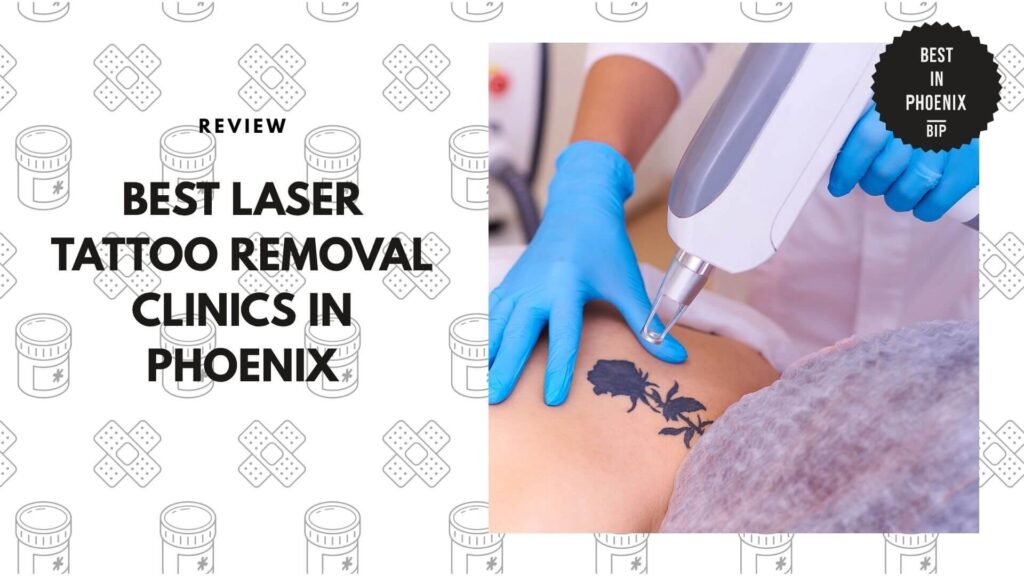 laser-tattoo-removal-clinics-in-phoenix