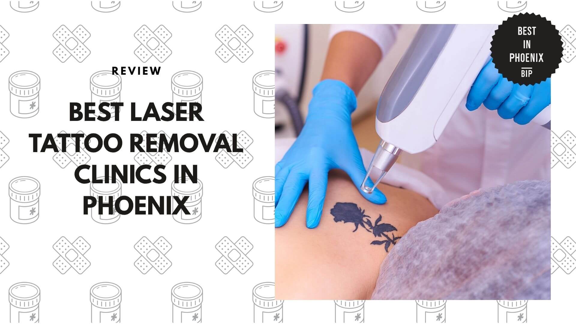 laser-tattoo-removal-clinics-in-phoenix